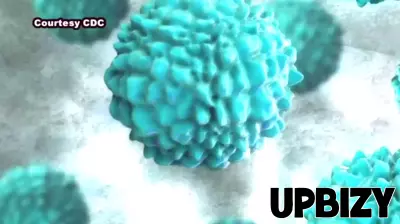 Cyclospora Infections Surpass 1,200 in Metro Detroit, Worrying Local Businesses